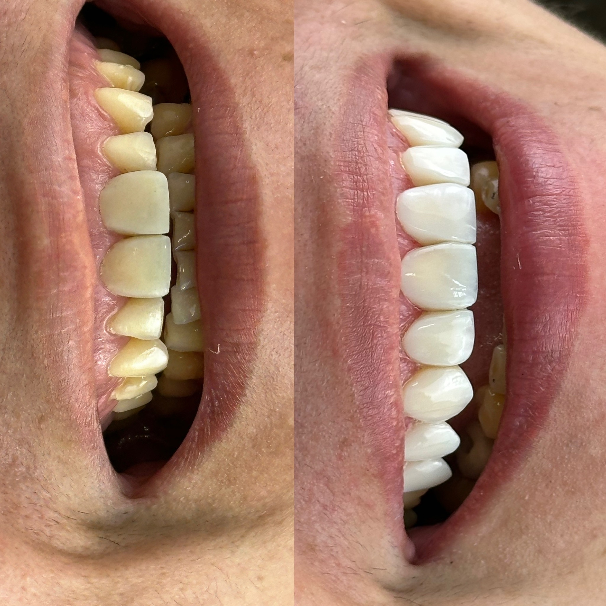 083F65C5-2978-47BE-90B0-1384F9A949B5