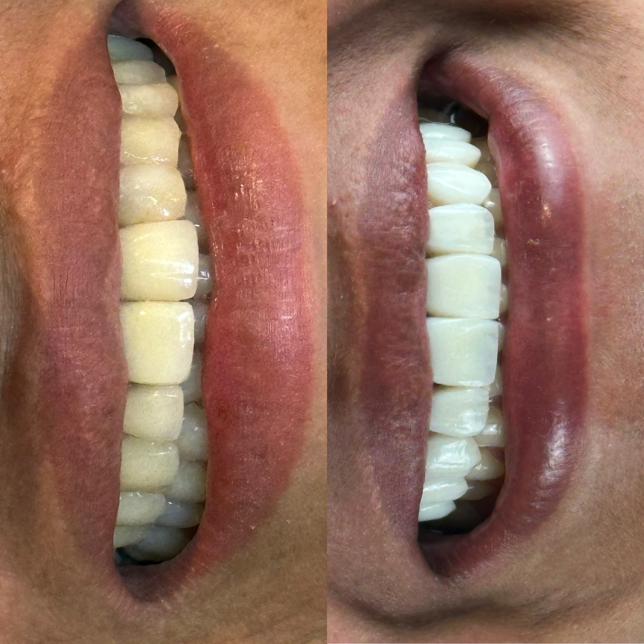 979FB08D-E15A-40A8-82DD-FD6E873164A5